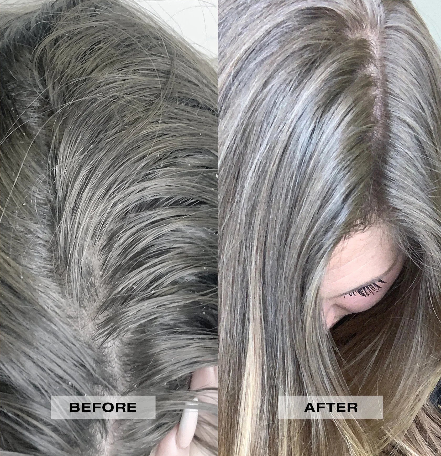 L’Anza Scalp Therapy Balancing Conditioner – Kalmerende Verzorging voor een Gezonde Hoofdhuid