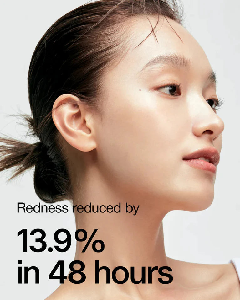 ANUA Heartleaf 77% Smoothing Toner 250 ml – Kalmerende Toner voor Gevoelige en Onzuivere Huid