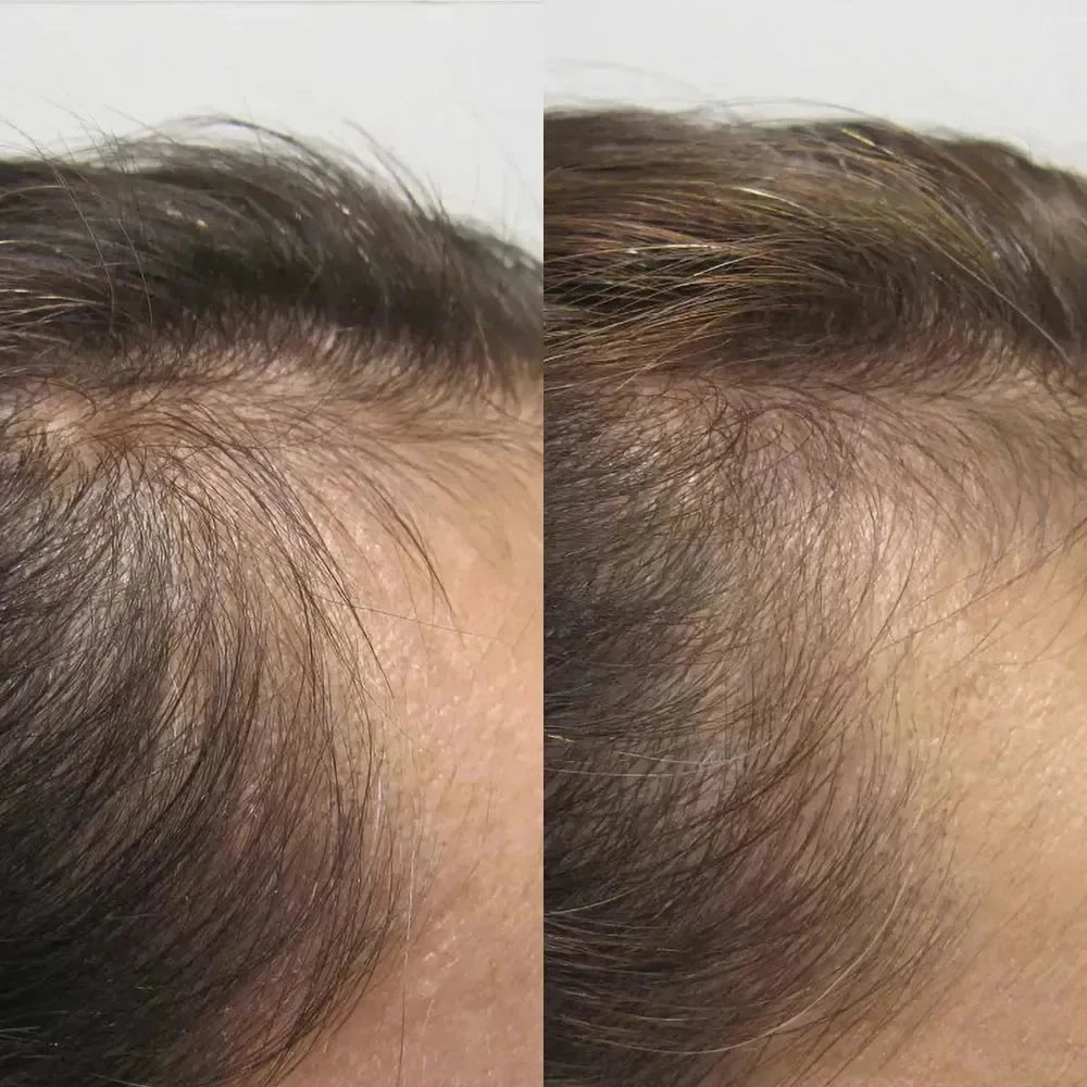 Viviscal Haargroei Supplementen voor Vrouwen – 180 Tabletten